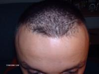 post-3051-1142497279_thumb.jpg
