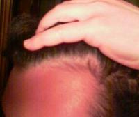 post-3086-1141842562_thumb.jpg