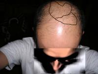 post-6679-1131112272_thumb.jpg